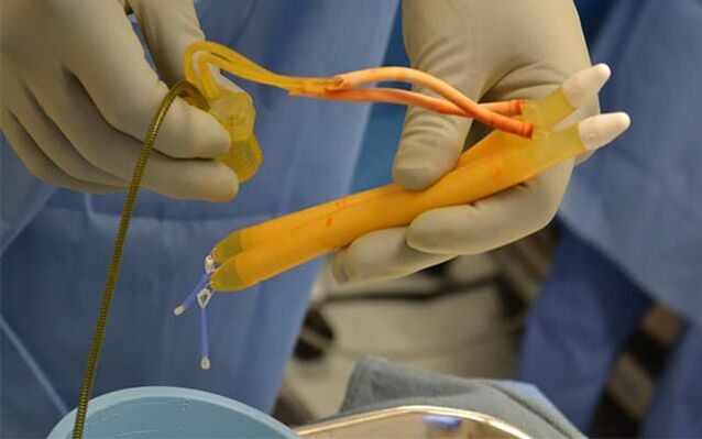 implants in the penis